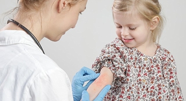 Alerji Testinin Pozitif Çıkması Aktif Bir Alerji Olduğunu Göstermeyebilir!