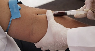 Çankaya Belediyesinin Sağlık Çalışanına Uluslararası Ödül