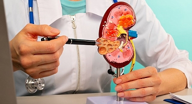 Otozomal dominant polikistik böbrek hastalığı ömür boyu sürüyor