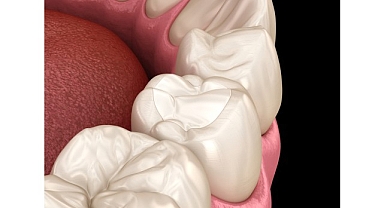 Estetik Dolguların Ömrünü Alışkanlıklarımız Belirliyor