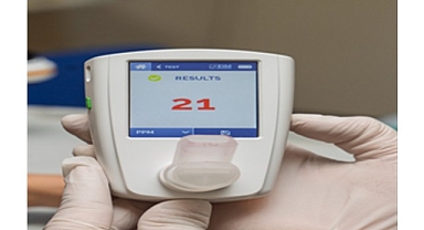 Sigarayı bırakmak isteyenlere Eşrefpaşa’dan sağlık desteği