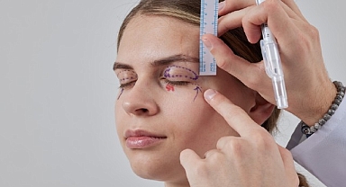 Sarkan Göz Kapakları: Estetik Bir İhtiyaç mı, Yoksa Ciddi Bir Görme Sorunu mu?