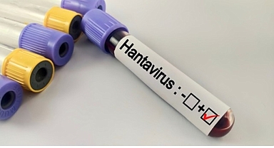 Hantavirüs Bir Salgına Dönüşür mü?